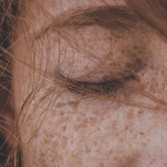 Sonnenbrandprävention und -behandlung: Ein umfassender Leitfaden