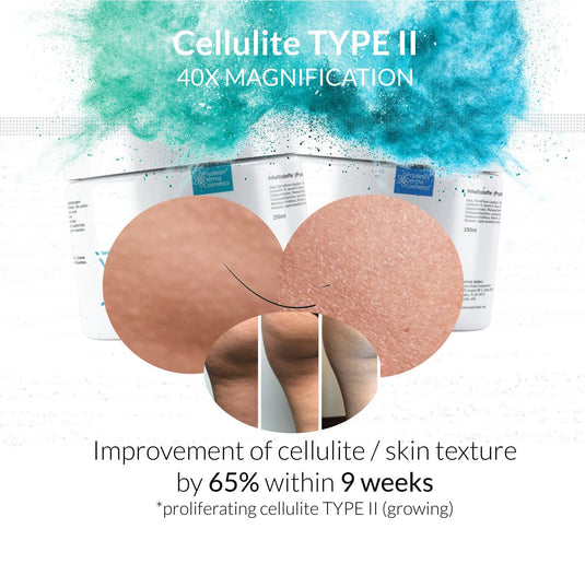 MyNaturalSecret - Pryalesin PROCELL 2 Day+Night Typ 1 - 3 Cellulite XXL Set